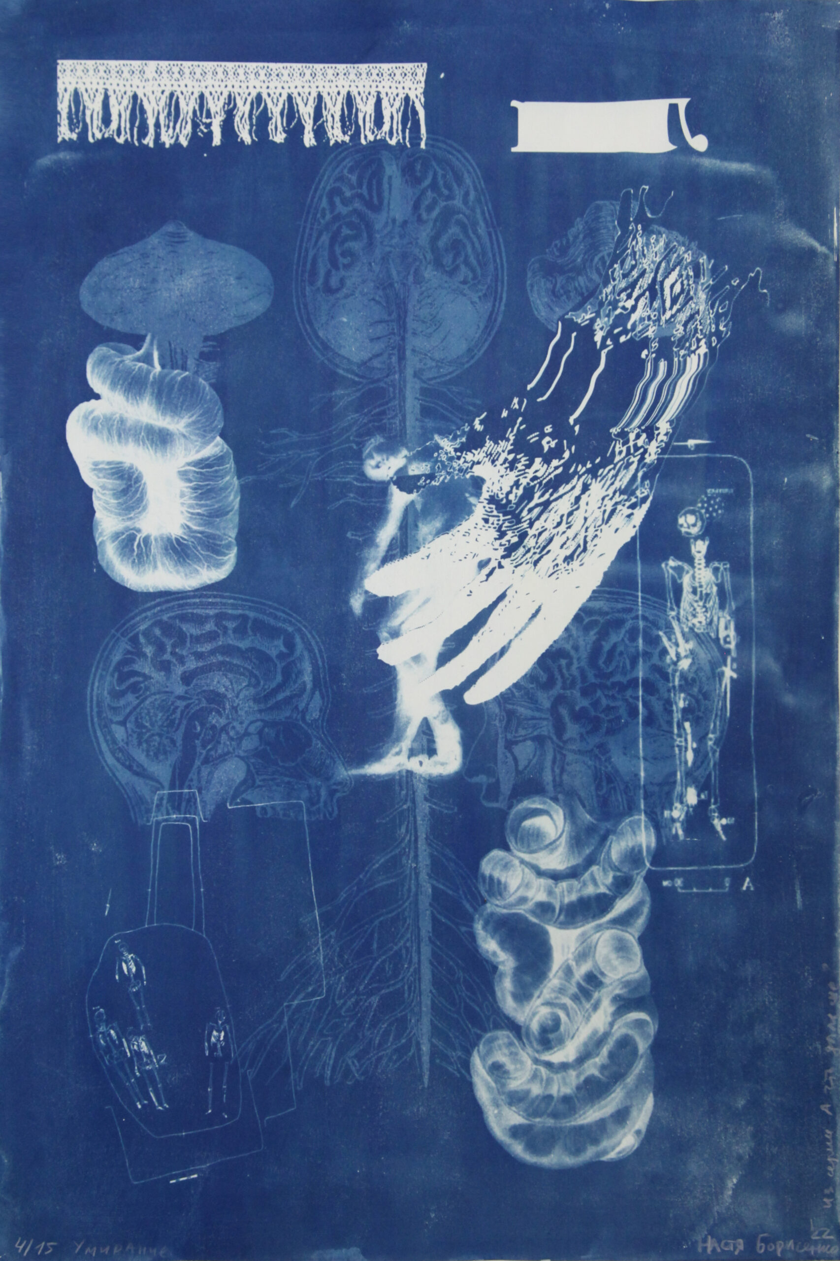 "Умирание" из серии "А что дальше?"